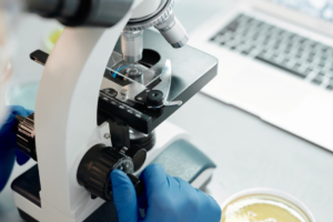 jewellery forensics