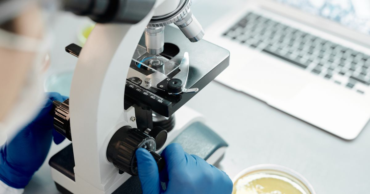 jewellery forensics