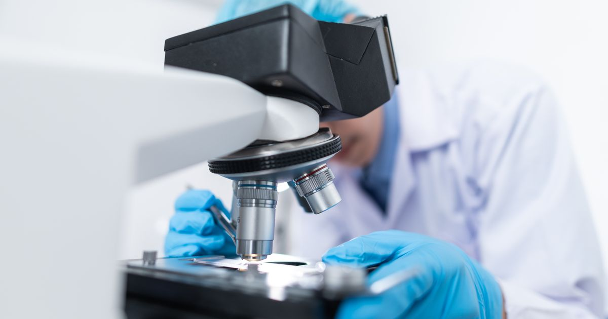jewellery forensics